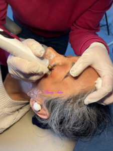 فیان پوست چیست