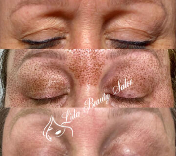 مرکز پلکسر در کرج